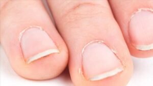 What health problems are associated with nail problems?